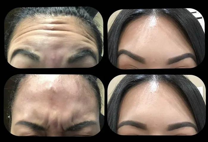 Advanced Aesthetics Artistry Picture 8