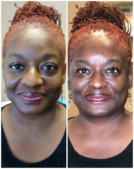 Advanced Aesthetics Artistry Picture 10