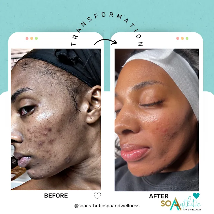 SO AESTHETIC SPA & WELLNESS Picture 10