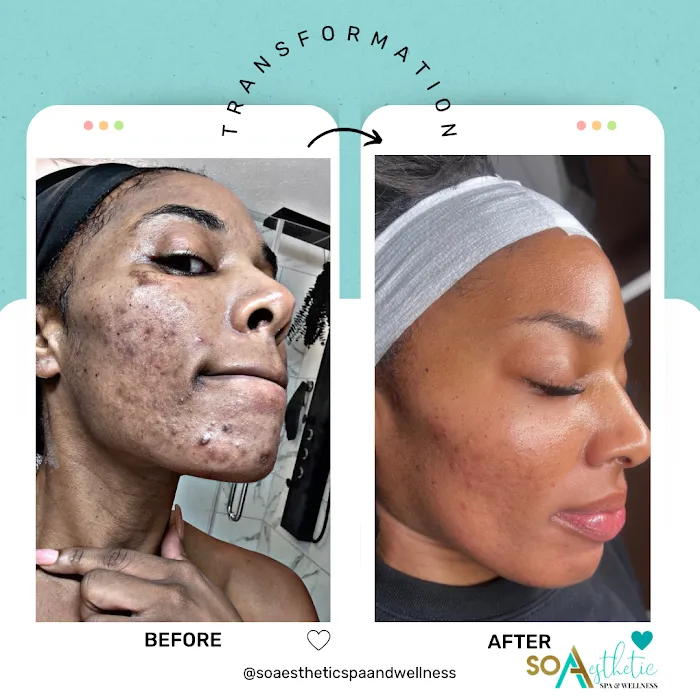 SO AESTHETIC SPA & WELLNESS Picture 9