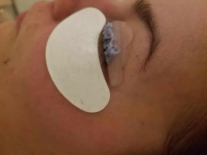 Focus Esthetics Picture 5