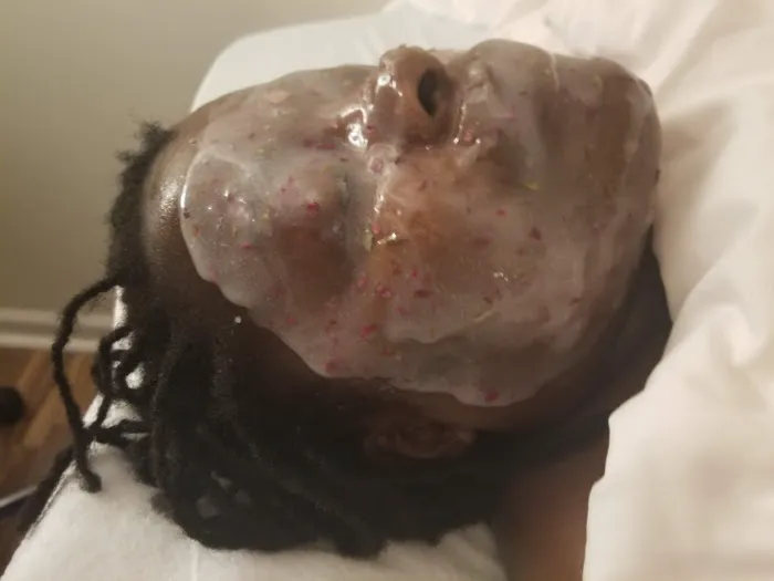 Focus Esthetics Picture 2