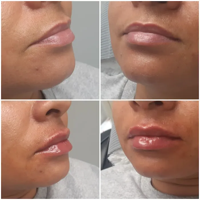 Advanced Aesthetics Artistry Picture 1