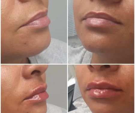 Advanced Aesthetics Artistry