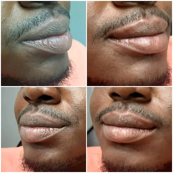 Advanced Aesthetics Artistry Picture 3