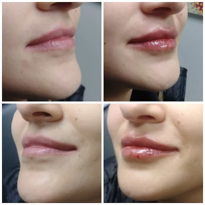 Advanced Aesthetics Artistry Picture 6