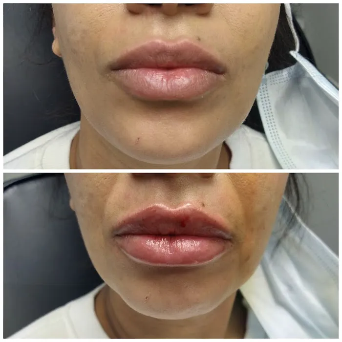 Advanced Aesthetics Artistry Picture 4