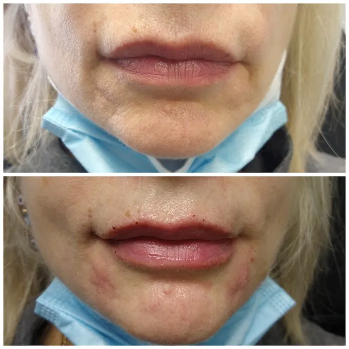 Advanced Aesthetics Artistry Picture 5