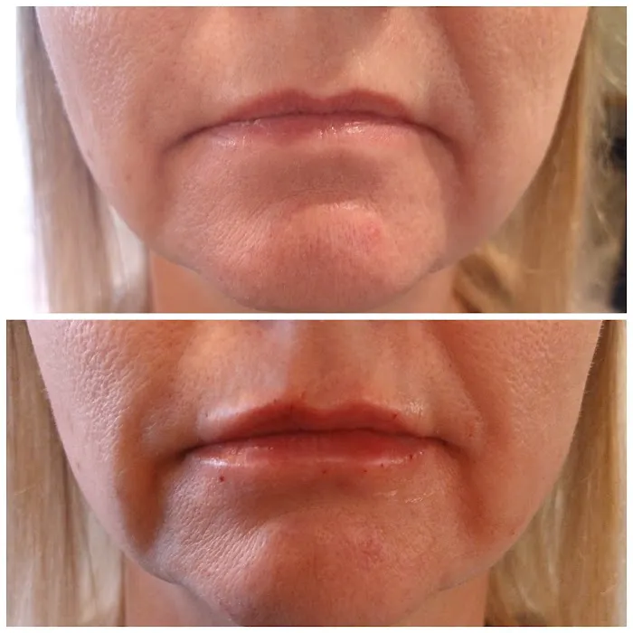 Advanced Aesthetics Artistry Picture 7