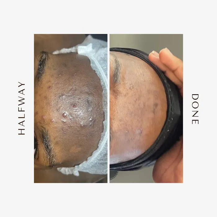 GLO Esthetics Picture 4