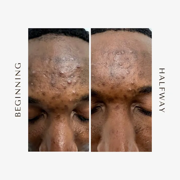 GLO Esthetics Picture 6