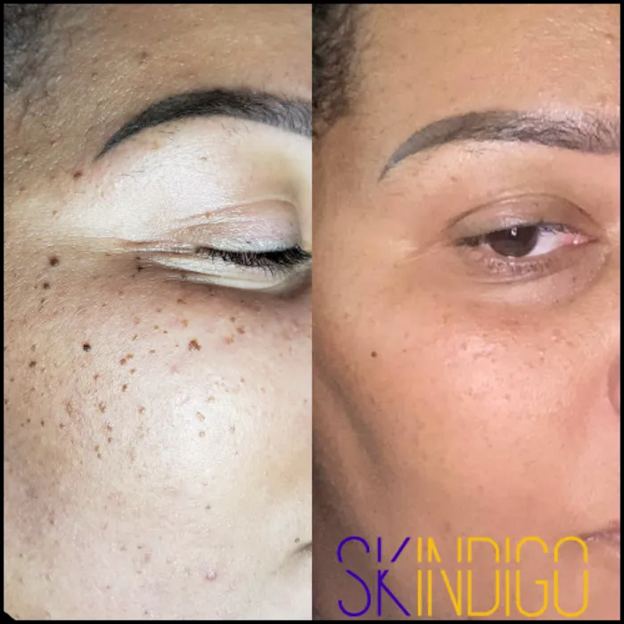 Skindigo Wellness Picture 6