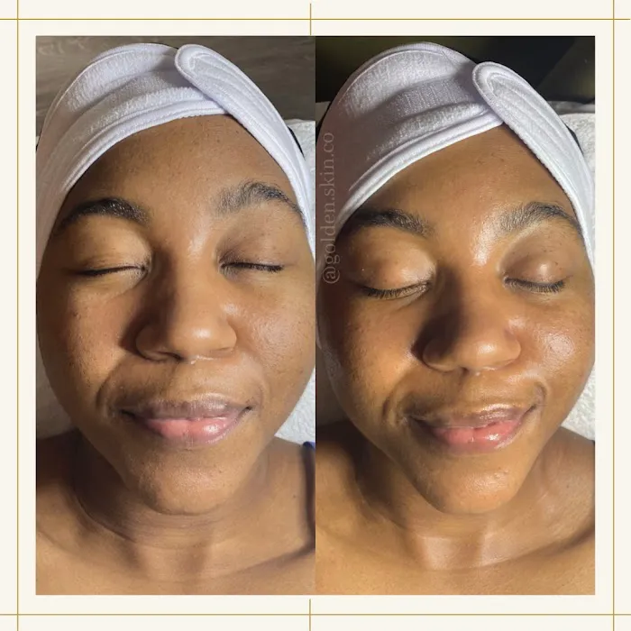 Golden Skin Co. Picture 6