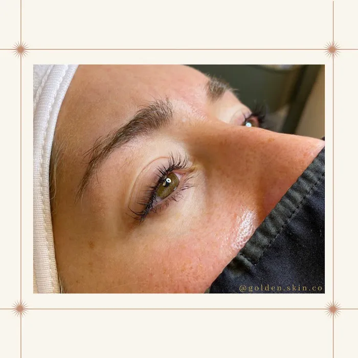 Golden Skin Co. Picture 5