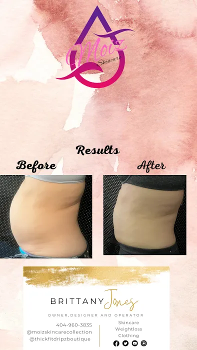 Moiz Skincare Collection Picture 5