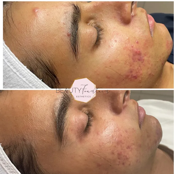 Beauty Fountain Esthetics Picture 3