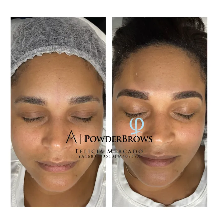 Beauty Fountain Esthetics Picture 9