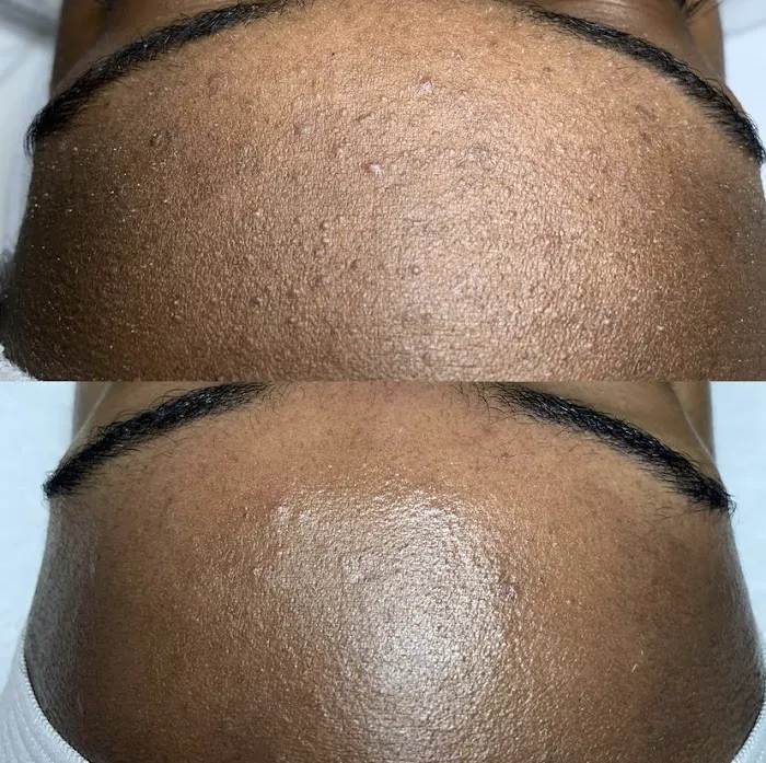 BARE SKINTENTIONS Picture 5