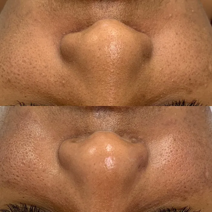 BARE SKINTENTIONS Picture 6