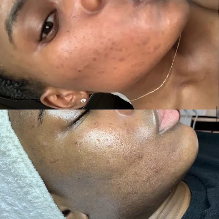 BARE SKINTENTIONS Picture 9