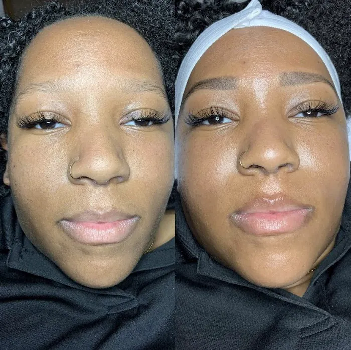 BARE SKINTENTIONS Picture 7