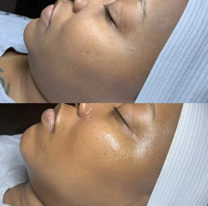 BARE SKINTENTIONS Picture 10