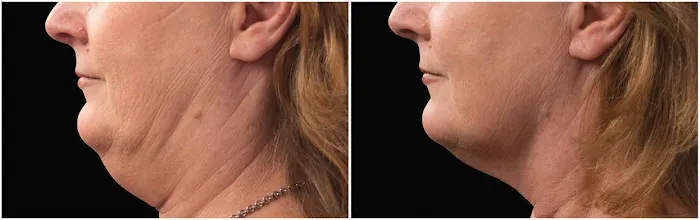 Skin Care at 5th Ave. Picture 10