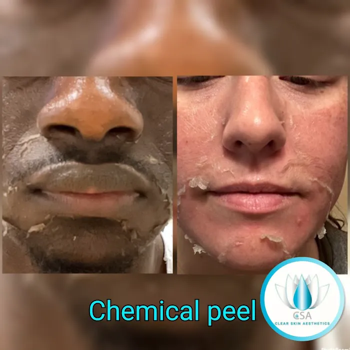 CSA Clear Skin Aesthetics Picture 8