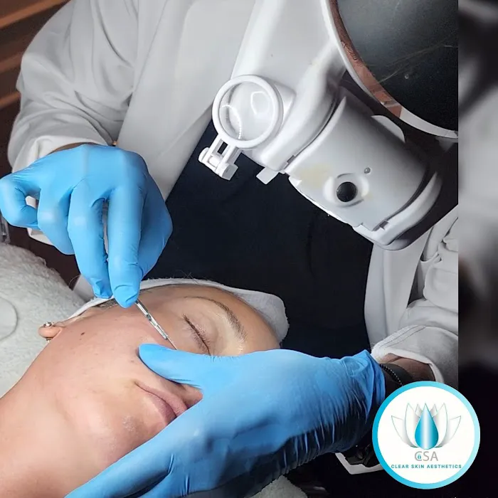 CSA Clear Skin Aesthetics Picture 6
