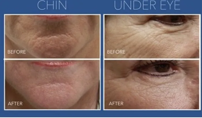 Esthetically Flawless Picture 4