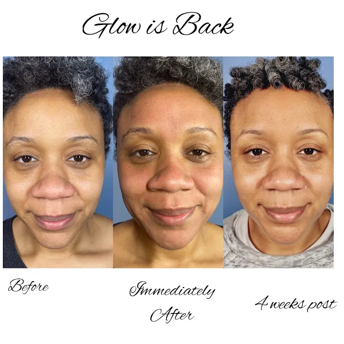 Enhanced Aesthetics by Jaalah Picture 7