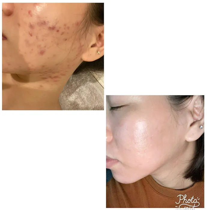 Yuna Skin & Body Solution Picture 10