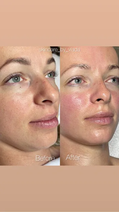 Skincare by Vlada Picture 9