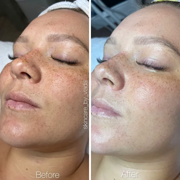 Skincare by Vlada Picture 8