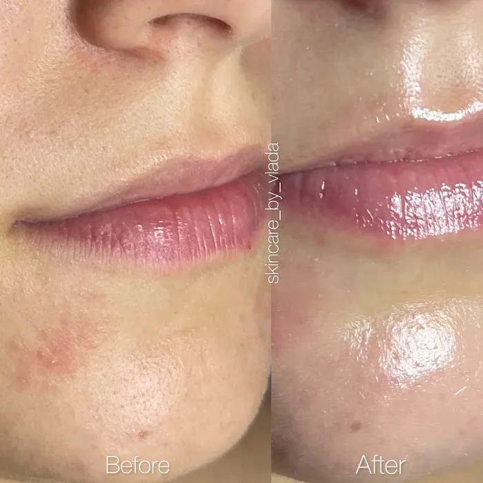 Skincare by Vlada Picture 10