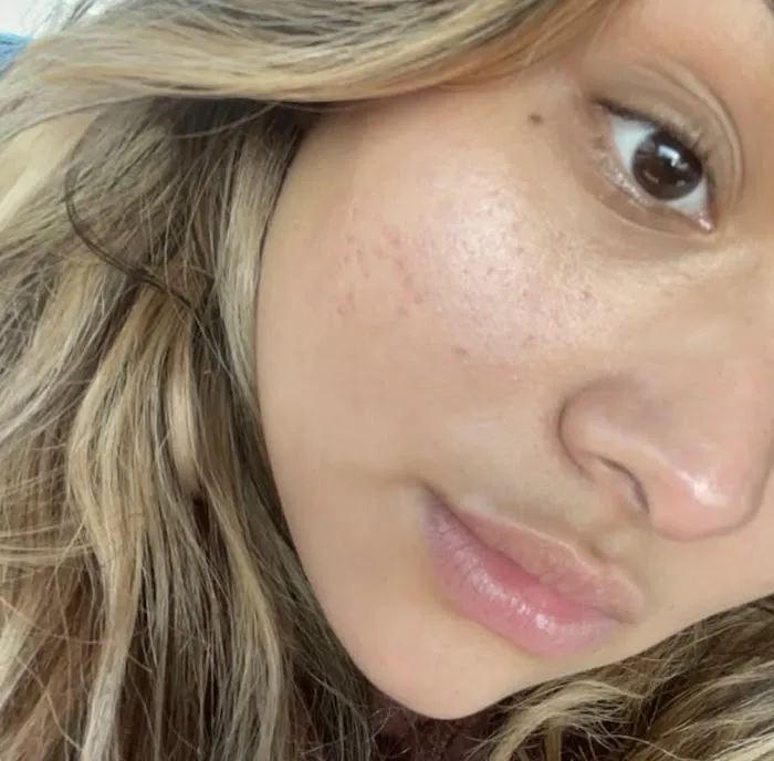 The Skin Sisters Picture 1