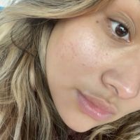 The Skin Sisters ico