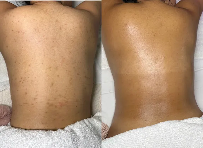 The Skin Sisters Picture 6