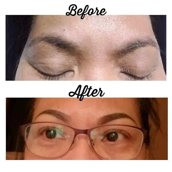 Forever Young Skin Care & Laser By Kimberly Picture 5