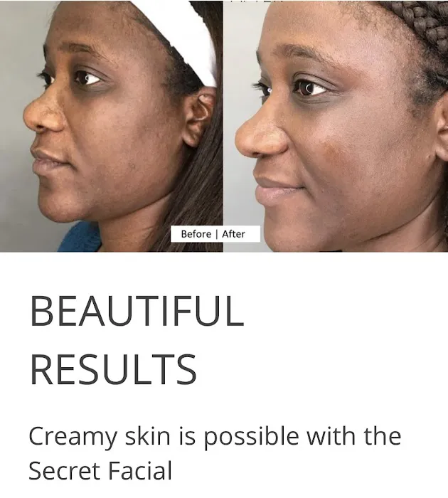 The Secret Skin Spa + Botox Picture 7