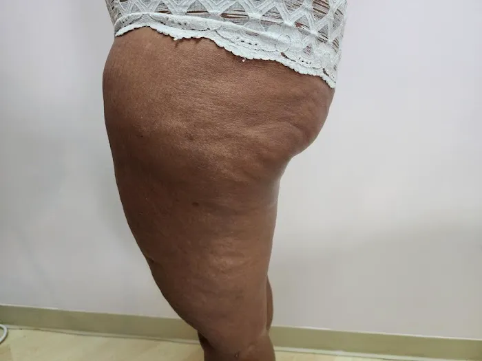 Melbis Motta Esthetics Picture 1