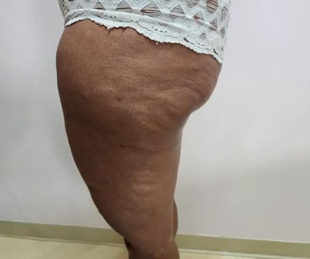 Melbis Motta Esthetics