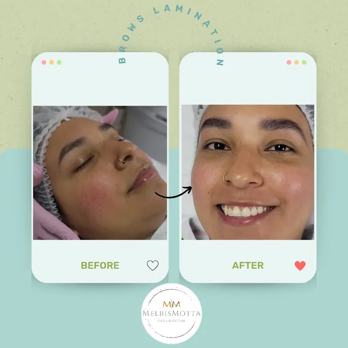 Melbis Motta Esthetics Picture 7