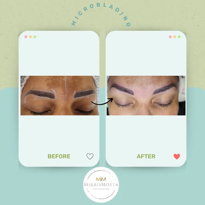 Melbis Motta Esthetics Picture 8