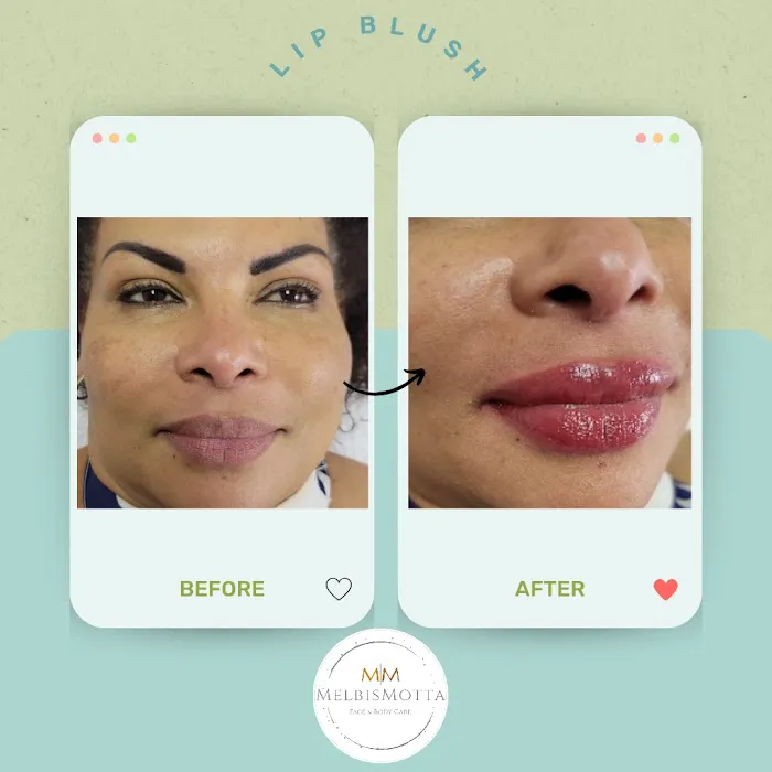 Melbis Motta Esthetics Picture 6