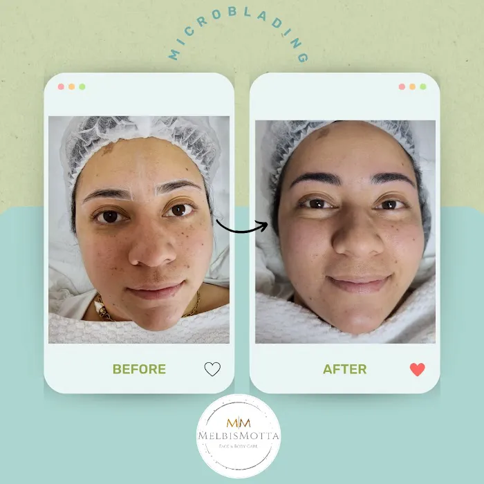 Melbis Motta Esthetics Picture 10