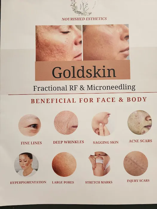 Nourished Esthetics & Wellness, LLC Picture 6