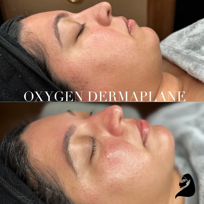 Victorious Aesthetics Picture 4