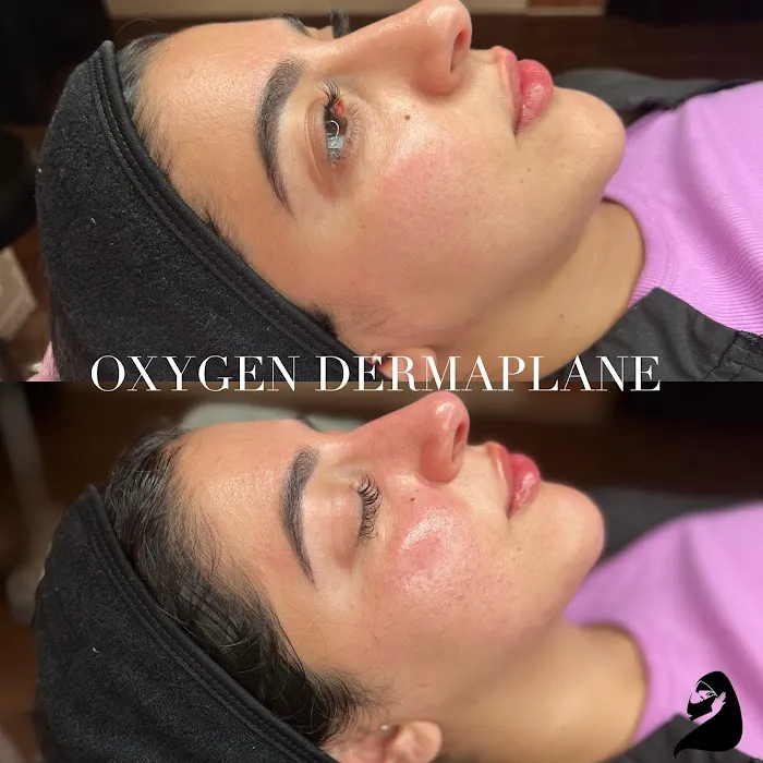 Victorious Aesthetics Picture 2