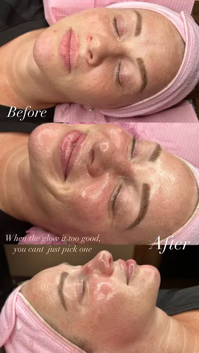 Victorious Aesthetics Picture 1